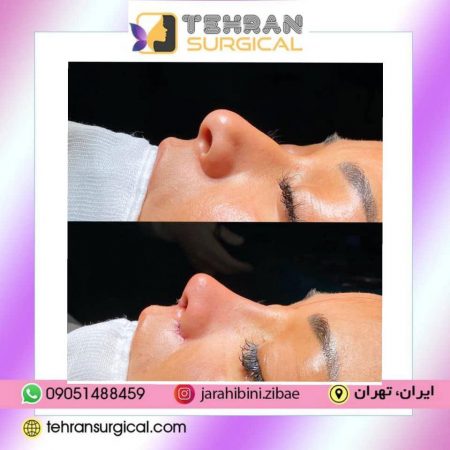 فرق بینی عروسکی و فانتزی