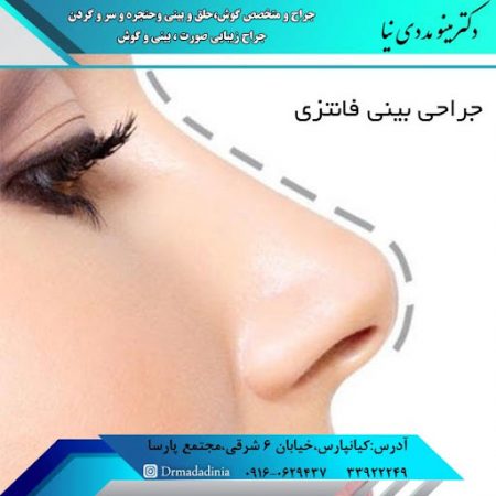 تفاوت بین بینی عروسکی و فانتزی
