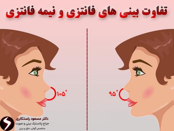 تفاوت بین بینی عروسکی و فانتزی