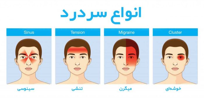 انواع سردرد
